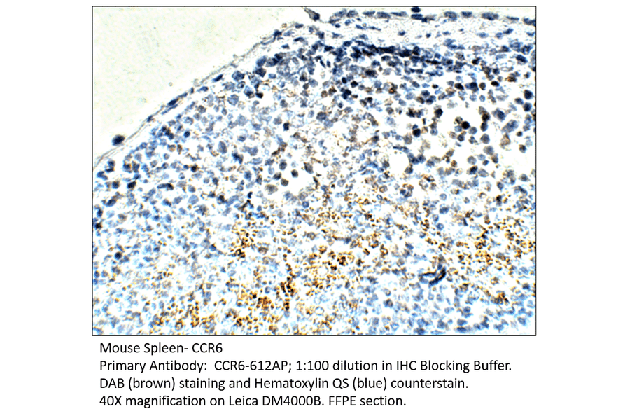 Anti-CCR6 Antibody from FabGennix (CCR6-612AP) - Antibodies.com