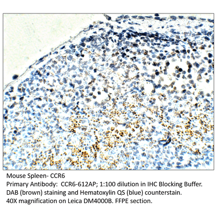 Anti-CCR6 Antibody from FabGennix (CCR6-612AP) - Antibodies.com