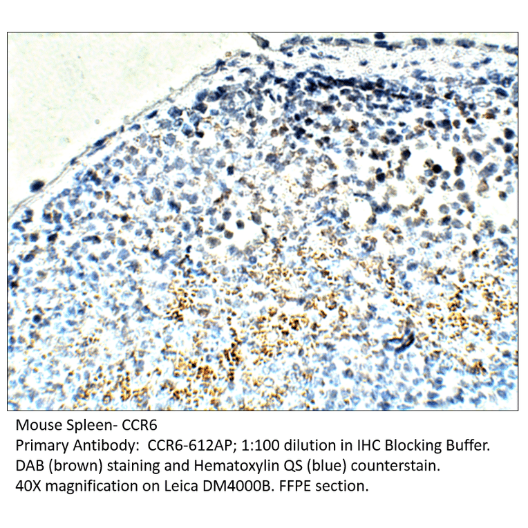 Anti-CCR6 Antibody from FabGennix (CCR6-612AP) - Antibodies.com