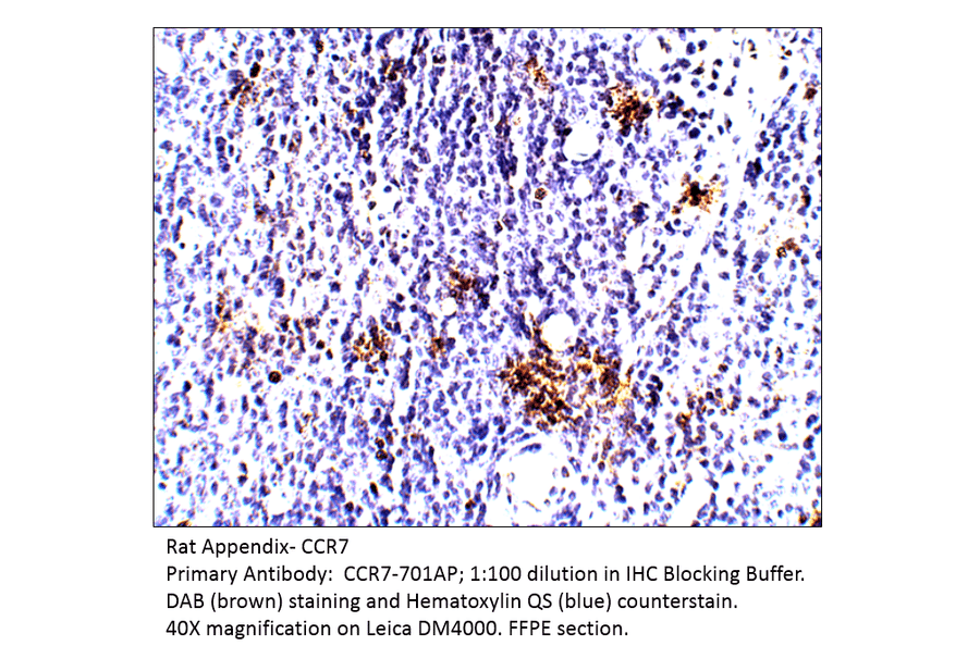 Anti-CCR7 Antibody from FabGennix (CCR7-701AP) - Antibodies.com