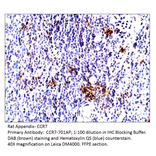 Anti-CCR7 Antibody from FabGennix (CCR7-701AP) - Antibodies.com