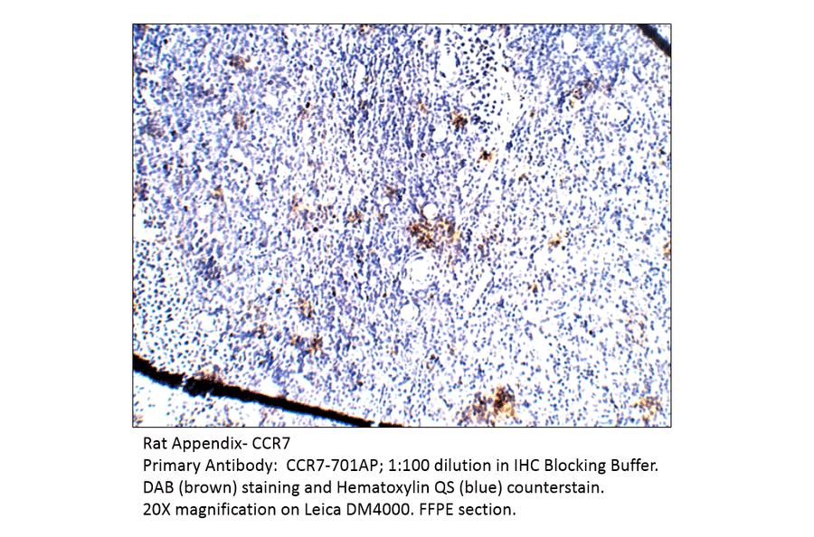 Anti-CCR7 Antibody from FabGennix (CCR7-701AP) - Antibodies.com