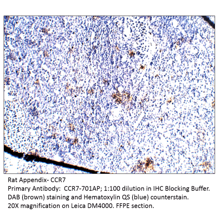 Anti-CCR7 Antibody from FabGennix (CCR7-701AP) - Antibodies.com