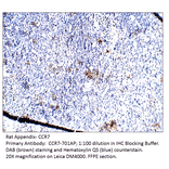 Anti-CCR7 Antibody from FabGennix (CCR7-701AP) - Antibodies.com