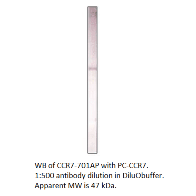 Anti-CCR7 Antibody from FabGennix (CCR7-701AP) - Antibodies.com