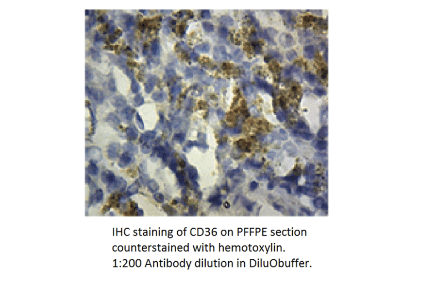 Anti-CD36 Antibody from FabGennix (CD36-101AP) - Antibodies.com