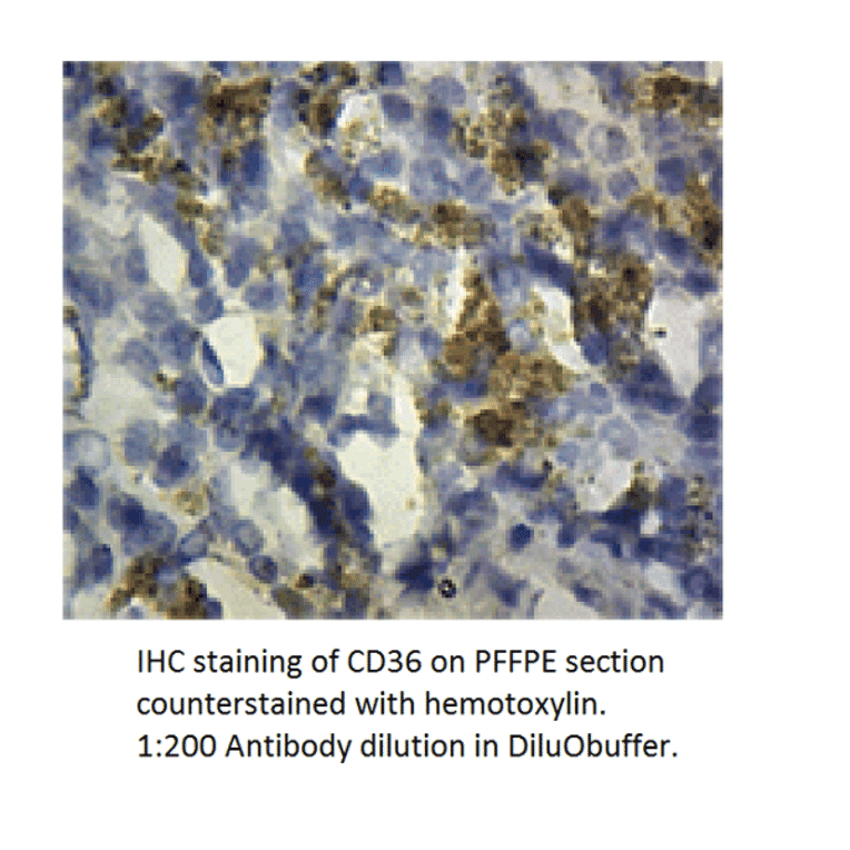 Anti-CD36 Antibody from FabGennix (CD36-101AP) - Antibodies.com