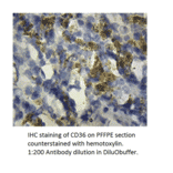 Anti-CD36 Antibody from FabGennix (CD36-101AP) - Antibodies.com