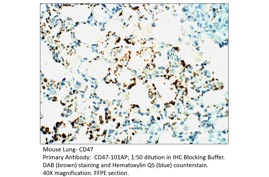 Anti-CD47 Antibody from FabGennix (CD47-101AP) - Antibodies.com