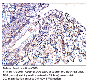 Anti-CD99 Antibody from FabGennix (CD99-101AP) - Antibodies.com