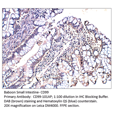 Anti-CD99 Antibody from FabGennix (CD99-101AP) - Antibodies.com