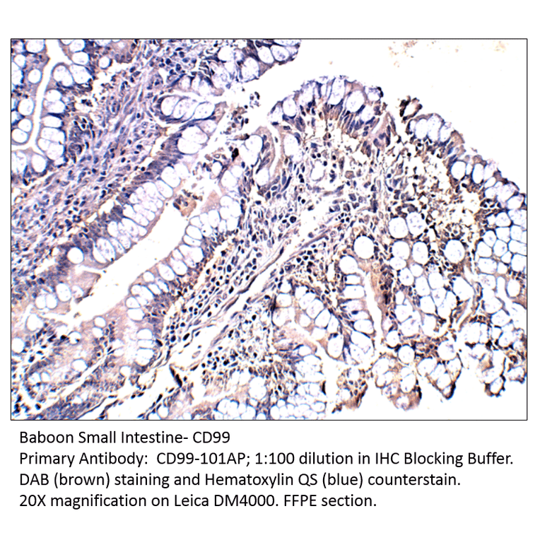 Anti-CD99 Antibody from FabGennix (CD99-101AP) - Antibodies.com