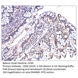 Anti-CD99 Antibody from FabGennix (CD99-101AP) - Antibodies.com