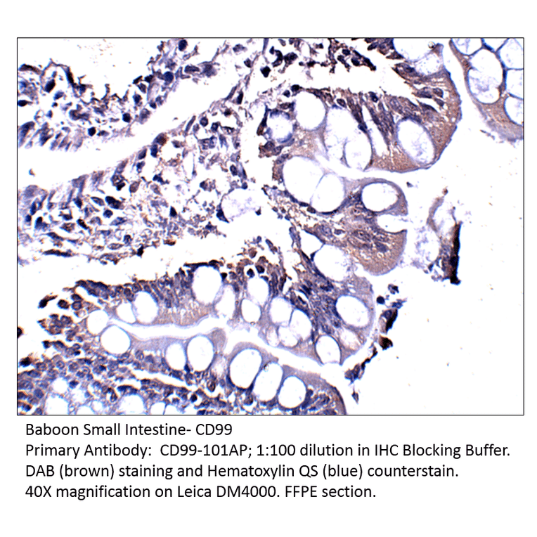 Anti-CD99 Antibody from FabGennix (CD99-101AP) - Antibodies.com