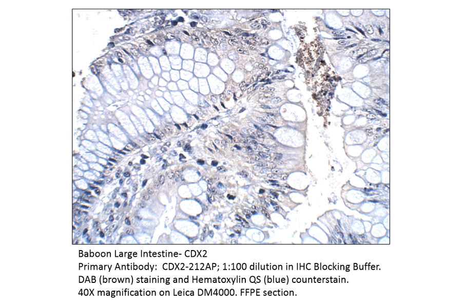 Anti-CDX2 Antibody from FabGennix (CDX2-212AP) - Antibodies.com