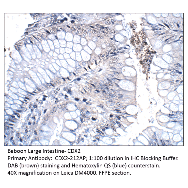 Anti-CDX2 Antibody from FabGennix (CDX2-212AP) - Antibodies.com