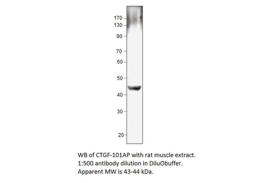 Anti-CTGF Antibody from FabGennix (CTGF-101AP) - Antibodies.com