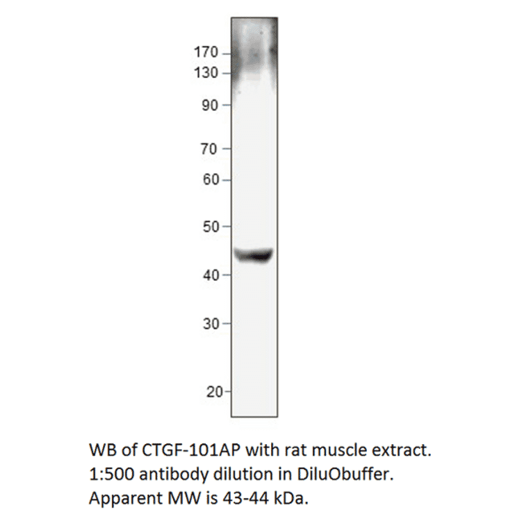 Anti-CTGF Antibody from FabGennix (CTGF-101AP) - Antibodies.com