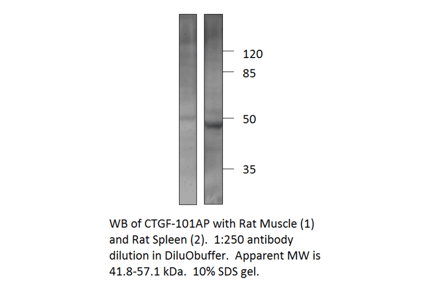Anti-CTGF Antibody from FabGennix (CTGF-101AP) - Antibodies.com