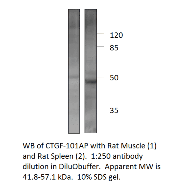 Anti-CTGF Antibody from FabGennix (CTGF-101AP) - Antibodies.com