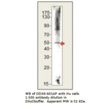 Anti-DDX6 Antibody from FabGennix (DDX6-601AP) - Antibodies.com