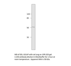 Anti-EDIL3 Antibody from FabGennix (DEL-101AP) - Antibodies.com