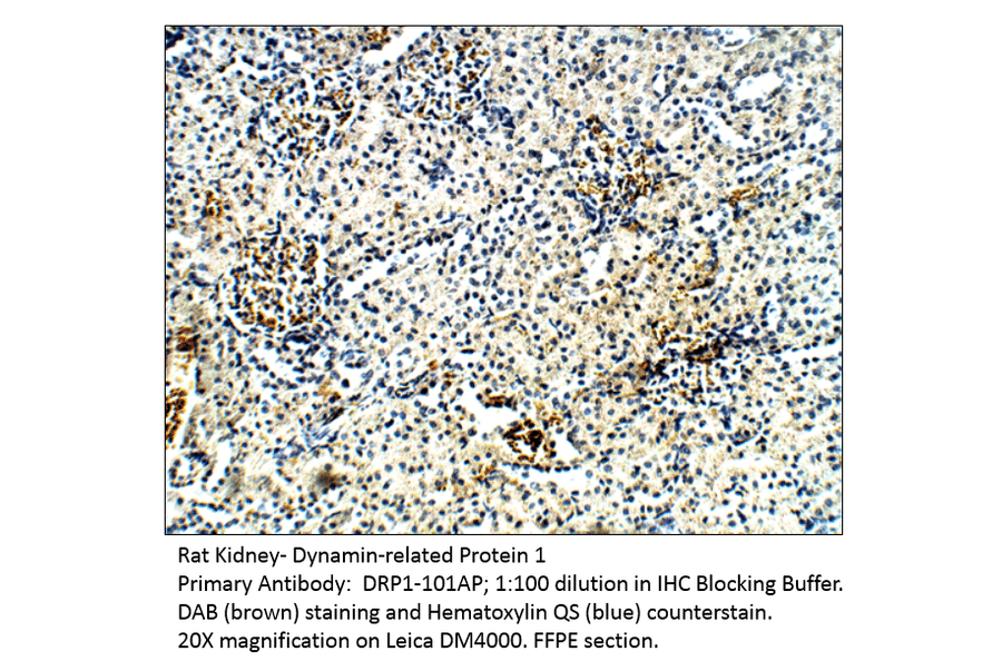 Anti-DRP1 Antibody from FabGennix (DRP1-101AP) - Antibodies.com