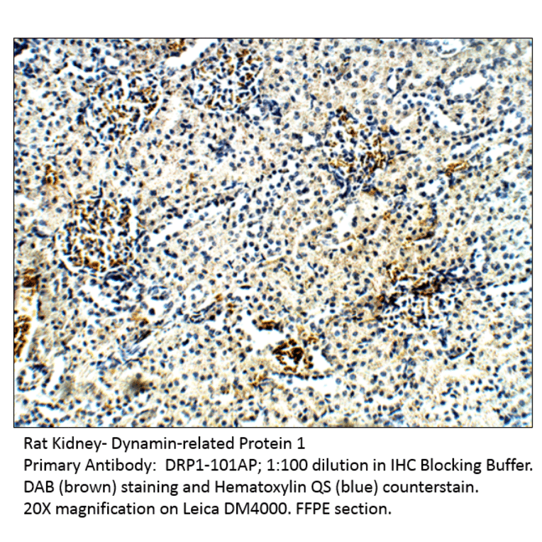 Anti-DRP1 Antibody from FabGennix (DRP1-101AP) - Antibodies.com