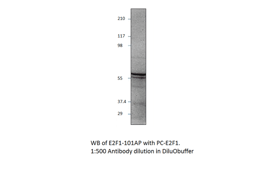 Anti-E2F1 Antibody from FabGennix (E2F1-101AP) - Antibodies.com
