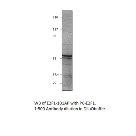 Anti-E2F1 Antibody from FabGennix (E2F1-101AP) - Antibodies.com