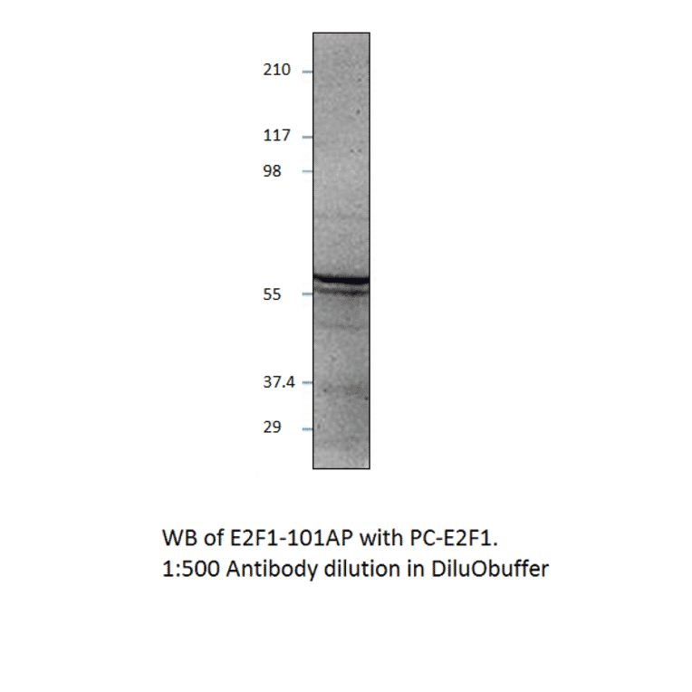 Anti-E2F1 Antibody from FabGennix (E2F1-101AP) - Antibodies.com