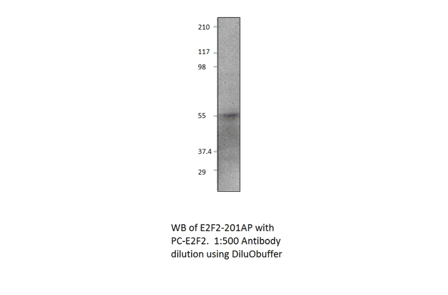Anti-E2F2 Antibody from FabGennix (E2F2-201AP) - Antibodies.com