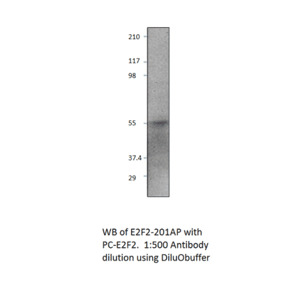 Anti-E2F2 Antibody from FabGennix (E2F2-201AP) - Antibodies.com