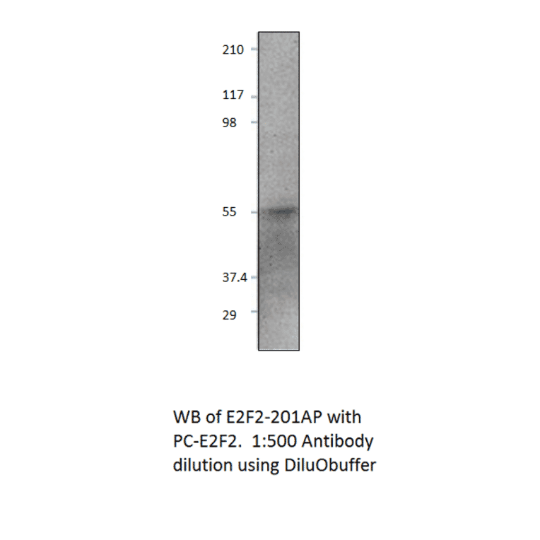 Anti-E2F2 Antibody from FabGennix (E2F2-201AP) - Antibodies.com
