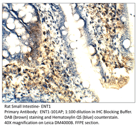 Anti-ENT1 Antibody from FabGennix (ENT1-101AP) - Antibodies.com