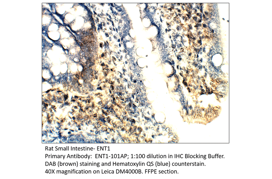 Anti-ENT1 Antibody from FabGennix (ENT1-101AP) - Antibodies.com