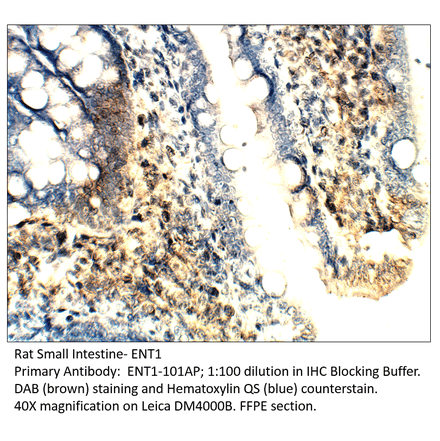 Anti-ENT1 Antibody from FabGennix (ENT1-101AP) - Antibodies.com
