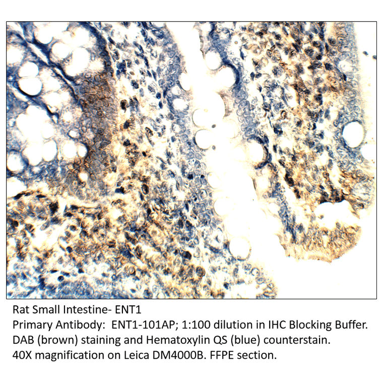 Anti-ENT1 Antibody from FabGennix (ENT1-101AP) - Antibodies.com