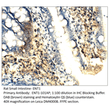 Anti-ENT1 Antibody from FabGennix (ENT1-101AP) - Antibodies.com