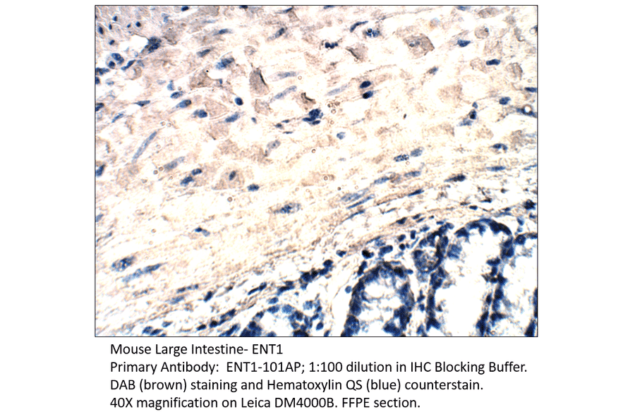 Anti-ENT1 Antibody from FabGennix (ENT1-101AP) - Antibodies.com