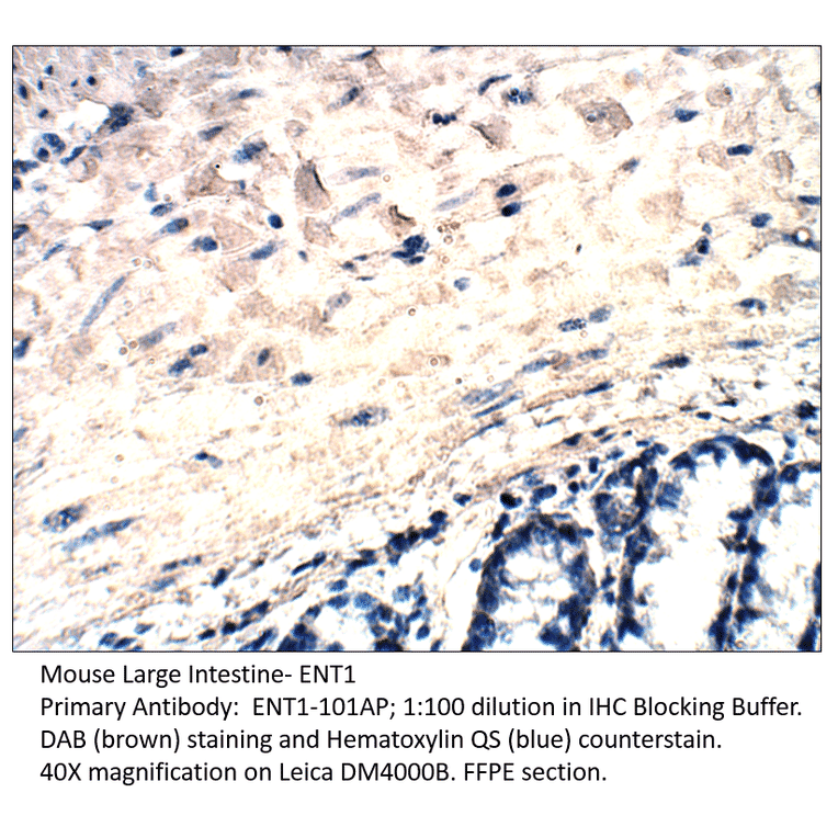 Anti-ENT1 Antibody from FabGennix (ENT1-101AP) - Antibodies.com