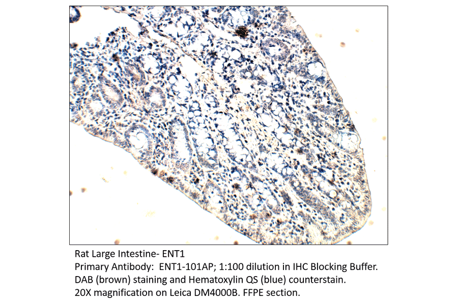 Anti-ENT1 Antibody from FabGennix (ENT1-101AP) - Antibodies.com