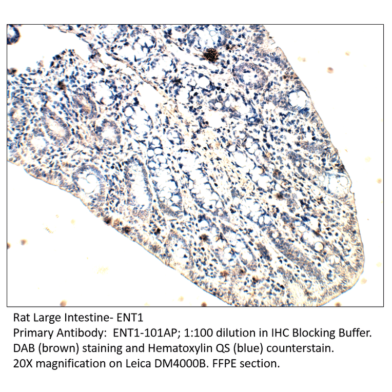 Anti-ENT1 Antibody from FabGennix (ENT1-101AP) - Antibodies.com