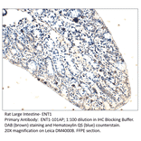 Anti-ENT1 Antibody from FabGennix (ENT1-101AP) - Antibodies.com