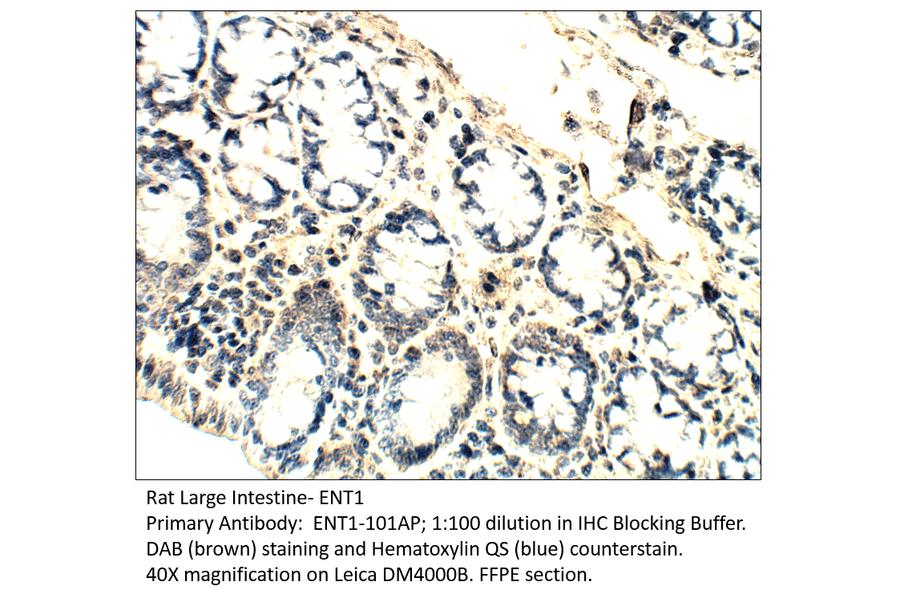 Anti-ENT1 Antibody from FabGennix (ENT1-101AP) - Antibodies.com