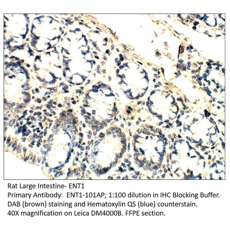 Anti-ENT1 Antibody from FabGennix (ENT1-101AP) - Antibodies.com