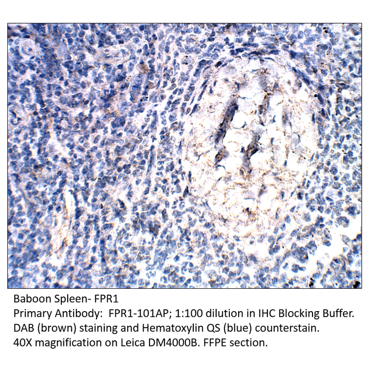 Anti-FPR1 Antibody from FabGennix (FPR1-101AP) - Antibodies.com