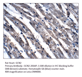 Anti-GCN2 Antibody from FabGennix (GCN2-201AP) - Antibodies.com