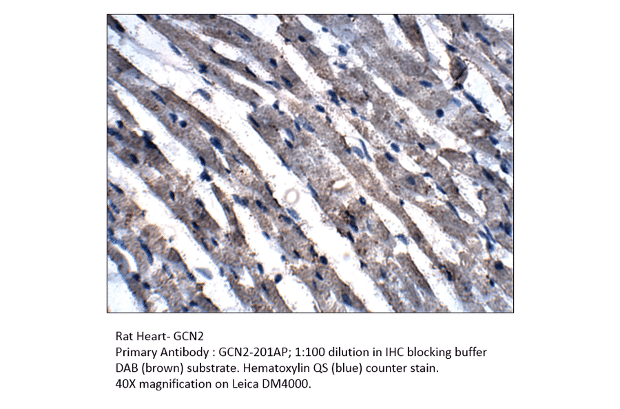 Anti-GCN2 Antibody from FabGennix (GCN2-201AP) - Antibodies.com