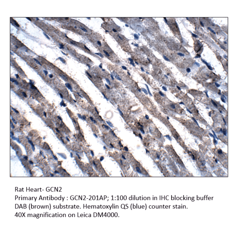 Anti-GCN2 Antibody from FabGennix (GCN2-201AP) - Antibodies.com